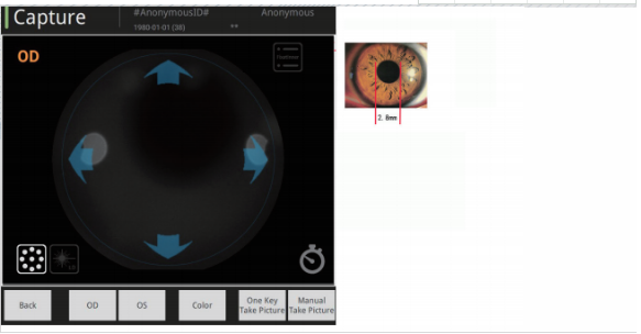 Широкий зрачок камеры 2.8mm Fundus поля не Mydriatic отображая область видимости 135°