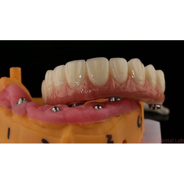 Professional Zirconia Dental Implant Crown Titanium CAD CAM Zirconia Crown China Dental Lab