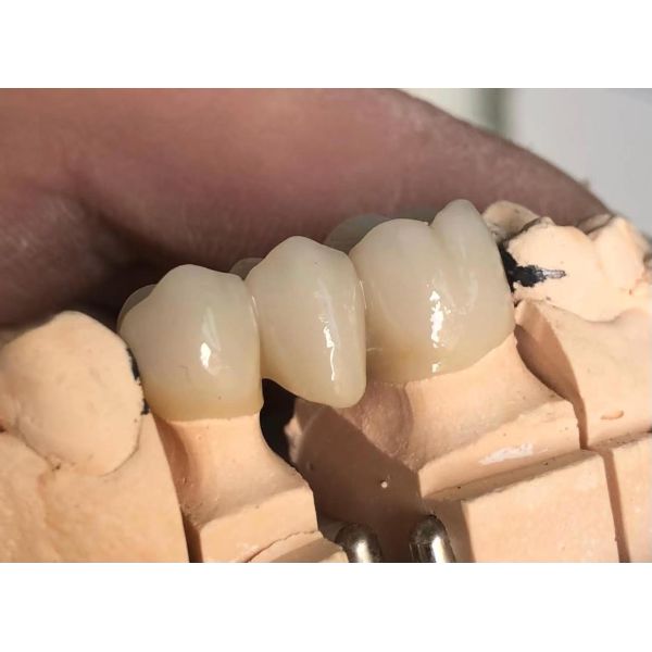 Dental Materials 3D Pro Multilayer Zirconia Block CAD CAM 98mm System Ceramic Block for Long Bridge