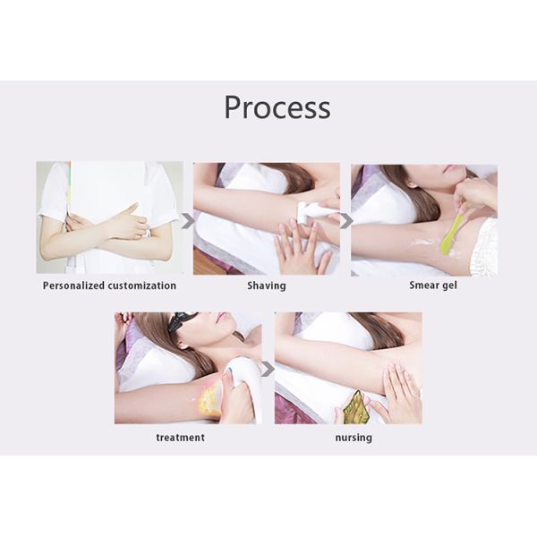 Prece Pulse IPL Therapy System SH Удаление сосудов Пигмент Удаление машины для клиники