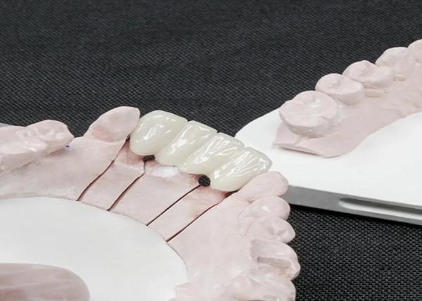 Premium Zirconia Dental Crowns for Superior Strength and Natural Aesthetics