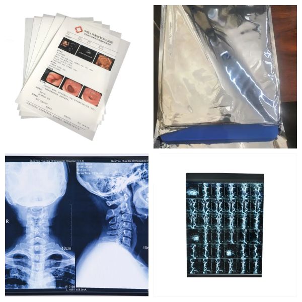 А4 Размер листов Синяя чернила медицинская пленка для медицинского изображения распечатка рентгеновского изображения CT, CR, DR, MTR PET