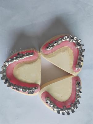 Customized All On 4 All On 6 The Perfect Solution For Dental Implant Restorations