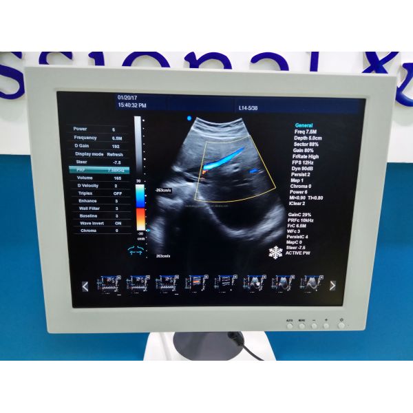 4D Color Doppler Ultrasound Machine Obstetrics And Gynecology Equipment Hospital