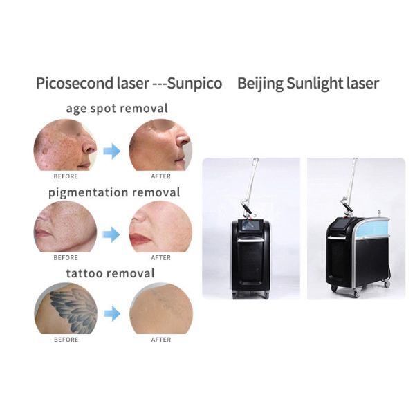 Salon / Clinic Picosecond Laser Tattoo Removal Machine For Acne Scar Treatment
