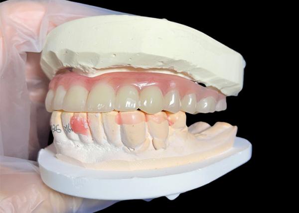 Dentures artificielles amovibles et confortables sur mesure