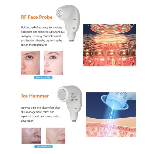 Máquina de microagujas de 300W RF 6 en 1 Máquina multifuncional para el cuidado de la piel