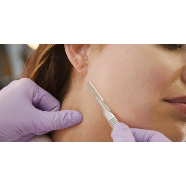 Хирургическое лезвие скальпеля ручек набора 3 Derma строгая для стороны