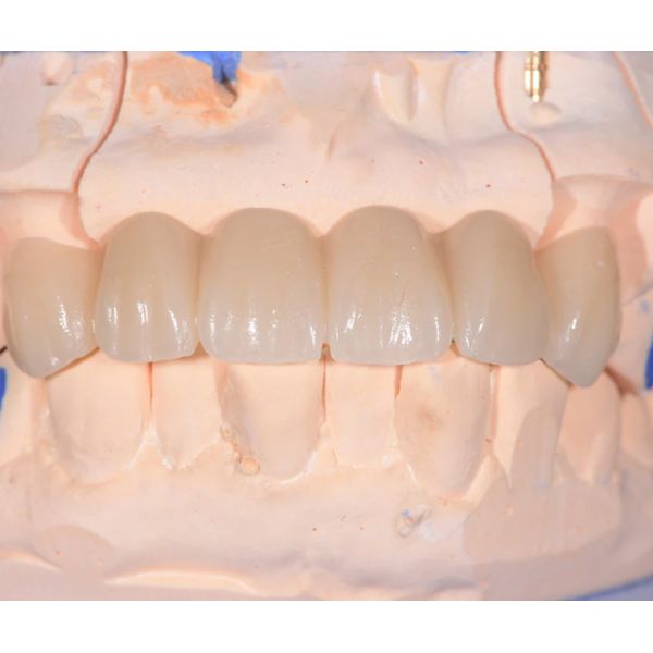 Zirconia градиентов 3D разнослоистый зубоврачебный прикрывает 16 теней для ложных зубов