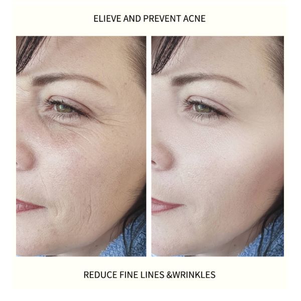 Витамин C и Hyaluronic кисловочная сыворотка разводя Hyaluronic кисловочную сыворотку водой