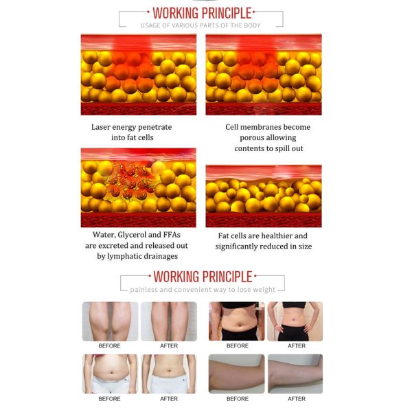 лазер 100mw 760nm Lipo уменьшая липолиз машины 4D ультразвуковой