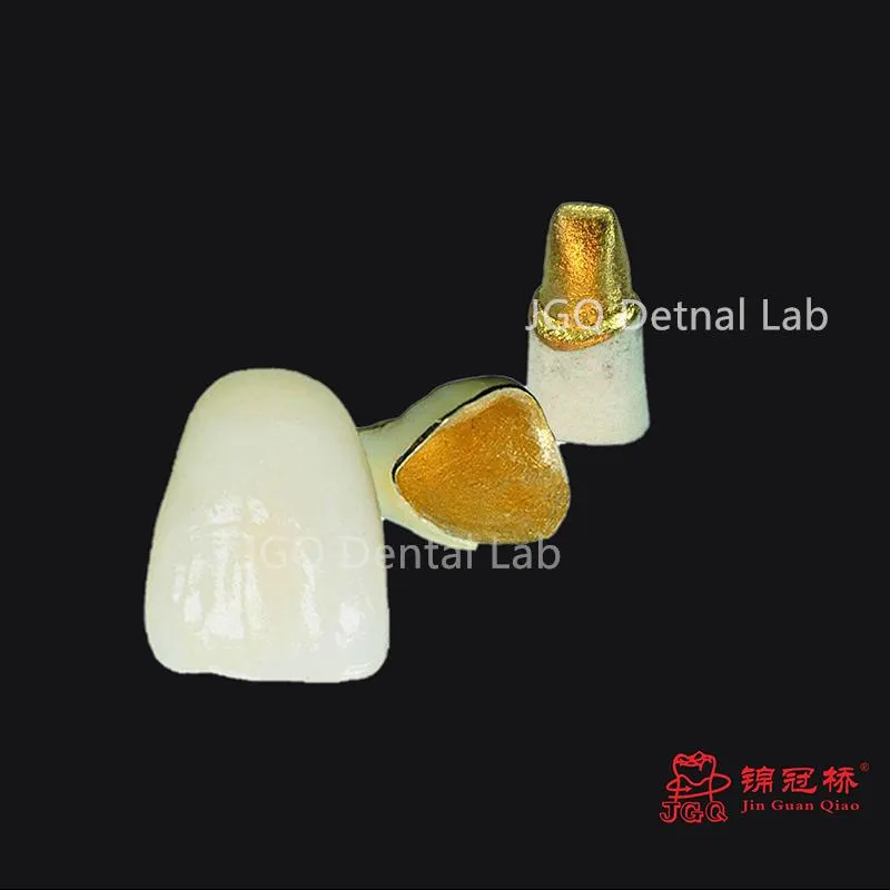 China Dental Lab Digital Full Dentures Using CAD/Cam Technology 3D Printing and Skilled Technicians
