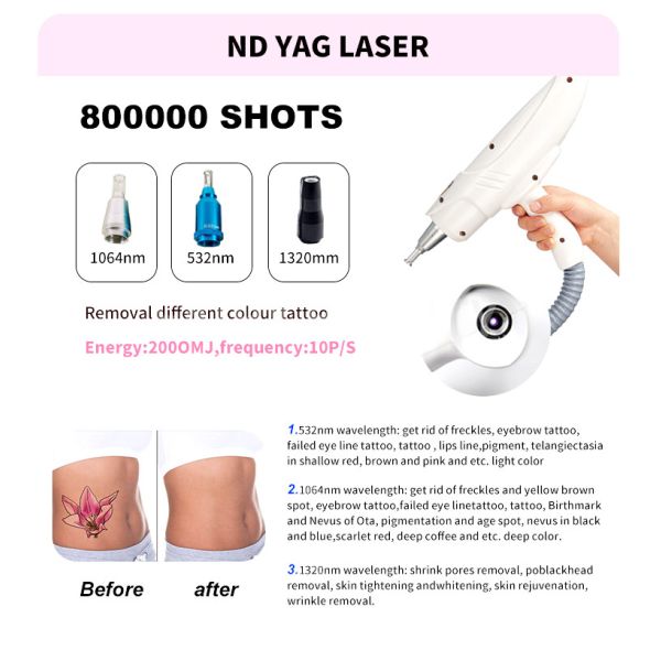 RF Tightening Skin Rejuvenation Machine 3 In 1 IPL Hair Removal Laser Tattoo Removal