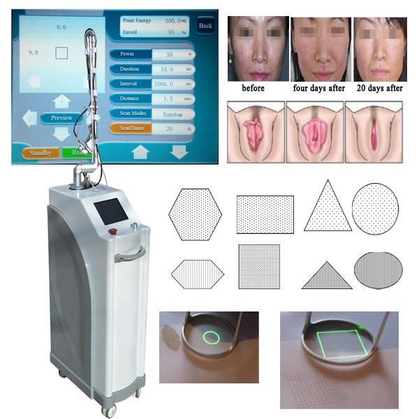 CO2 fractional laser wrinkle removal machine laser female rejuvenation surgery