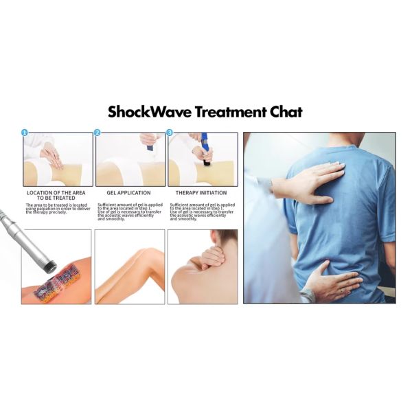 Pain Relief Muscle Bone Tissue Regeneration Treatment Extracorporeal Shockwave Machine