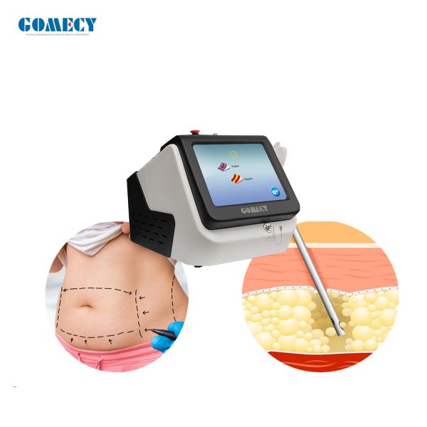 980 нм лазерная липосакционная машина для похудения