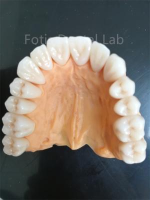 Advanced Multi Layered Zirconia For Superior Wear And Corrosion Resistance