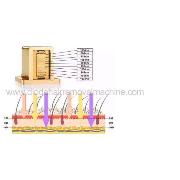 Stable Output 808 Laser Hair Removal Device Beauty Salon Equipment ISO13485