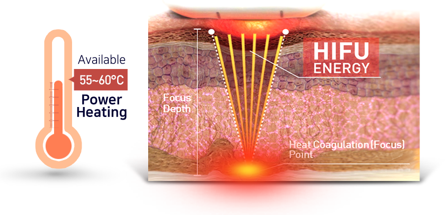 Piel que aprieta 27000 la máquina facial de los cartuchos HIFU de los tiros 7