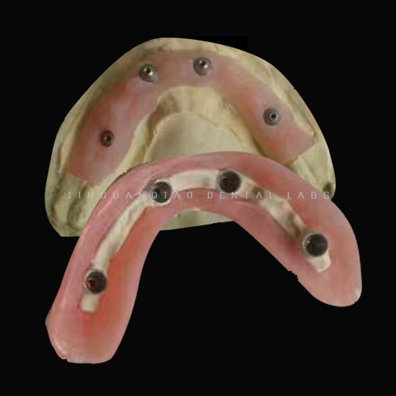 Permanent Restoration Full Contour Zirconia Crown Dental Implant with Custom Milled Titanium Frame