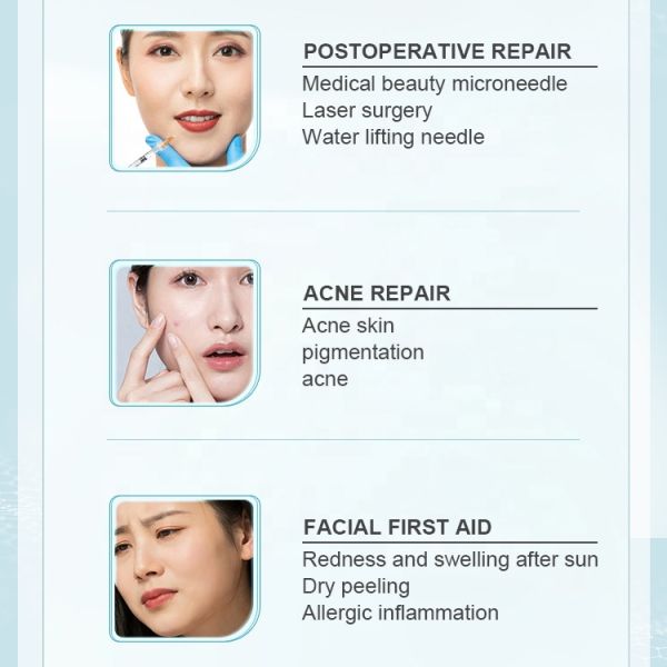 Factory Stock Recombinant TYPE III Humanized Collagen for Quick Calm Skin Repair Moisturizing Face SPA Exclusive Use