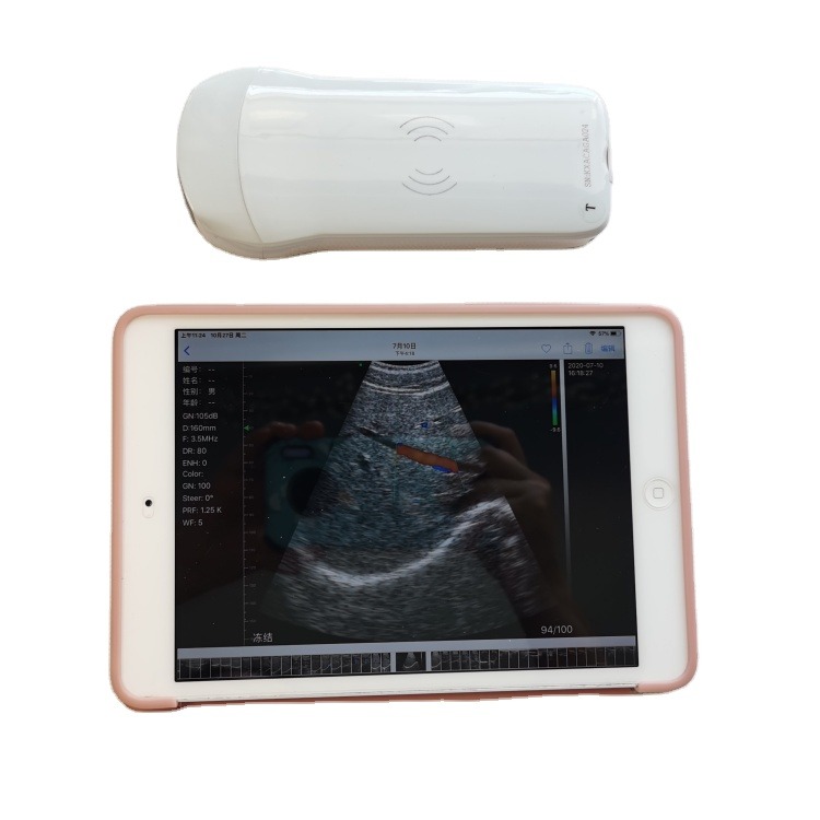 GYN High Quality Portable Veterinary Fast Delivery 3d Daignosis Medical Horse Ultrasound Machine For Cow