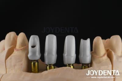 Custom Dental Implant Zirconia Abutment For Single Or Multiple Unit Restorations