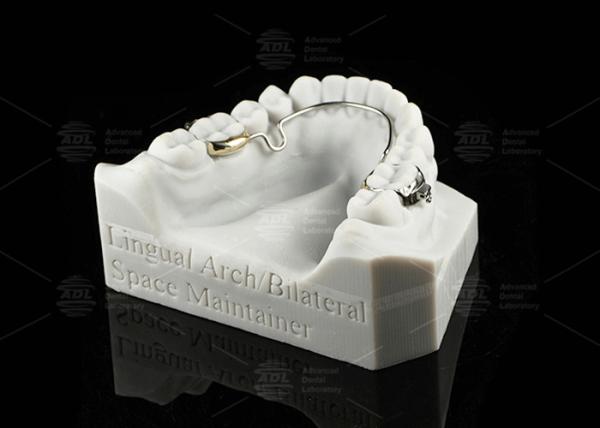 Lingual Arch Biliteral Space Maintainer Stainless Steel Teeth Space Maintainers