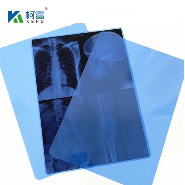 14*17in Medical X-Ray/CT/DR Dry Scan Film For X-Ray Laser Image Printer And Thermal Image Printer Equipment