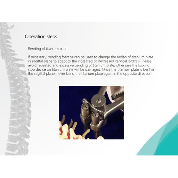 Spine Anterior Cervical Plate Titanium Cervical Plate Implant Orthopedic Surgery CE Certification
