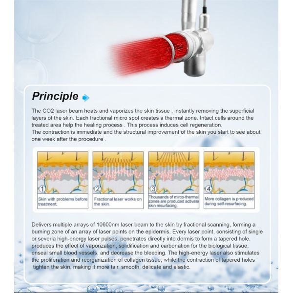 Машина лазера Laser/Co2 самого нового СО2 Protable частичная хирургическая медицинская