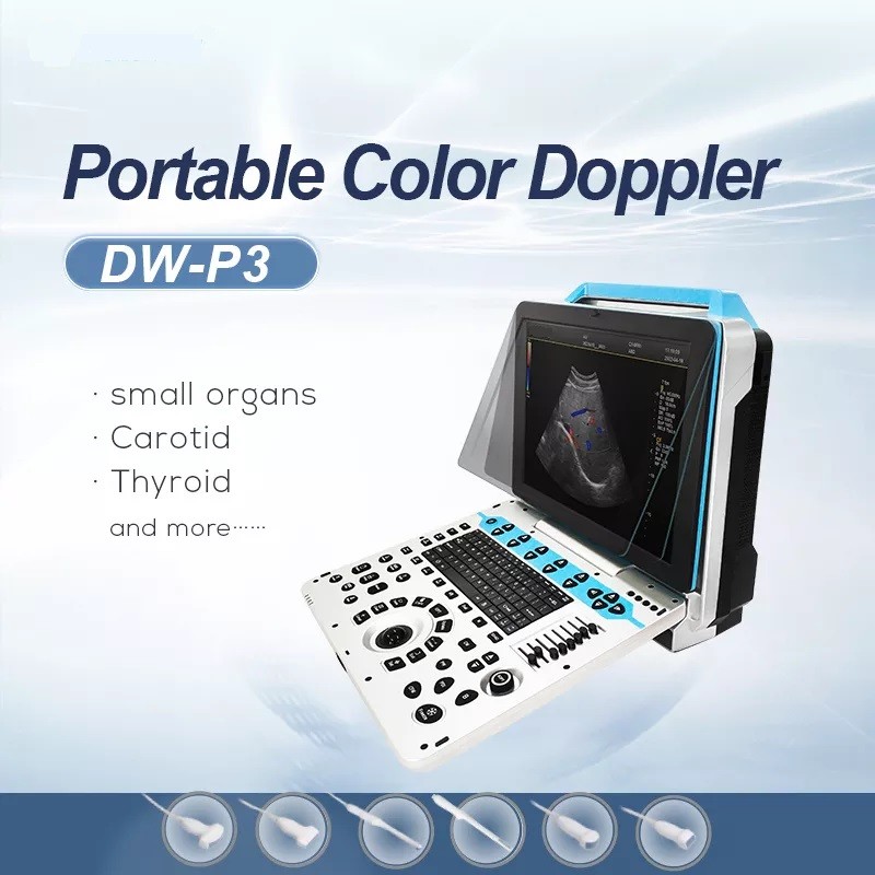Gynecology акушерства ультразвука Doppler цвета Ecografo Portatil 3D 4D 5D
