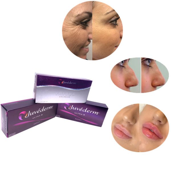 Rejuvenezca al OEM ácido hialurónico reticulado piel del llenador