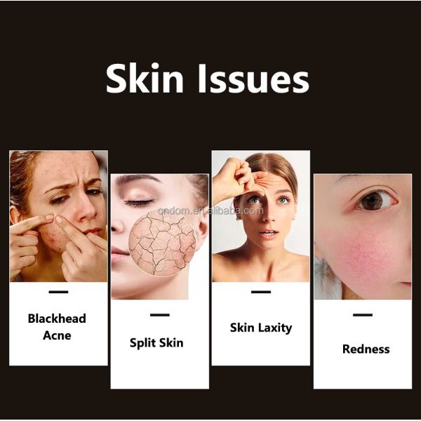 Compact Skin Led Facial Light Therapy for Acne Improvement Professional Grade