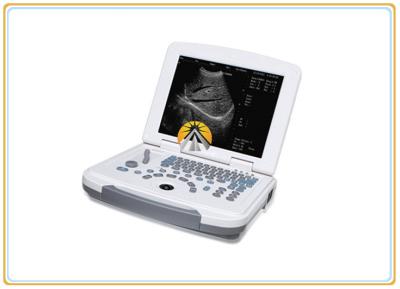 12.1 Inch LED Display Ultrasound Scan Machine 96 Elements Convex Probe