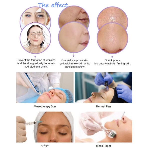 Месо решения Месотерапы Хялуроник кислоты сыворотки для заботы кожи 5мл/пробирки