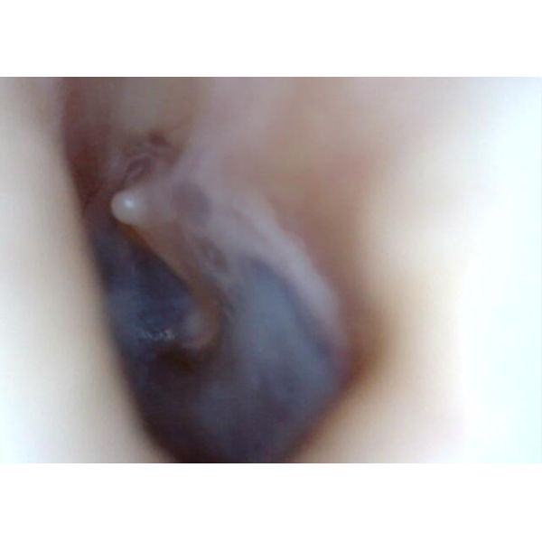 Cámara Wifi intraoral de la resolución 1280*720 de la distancia de transmisión los 6m