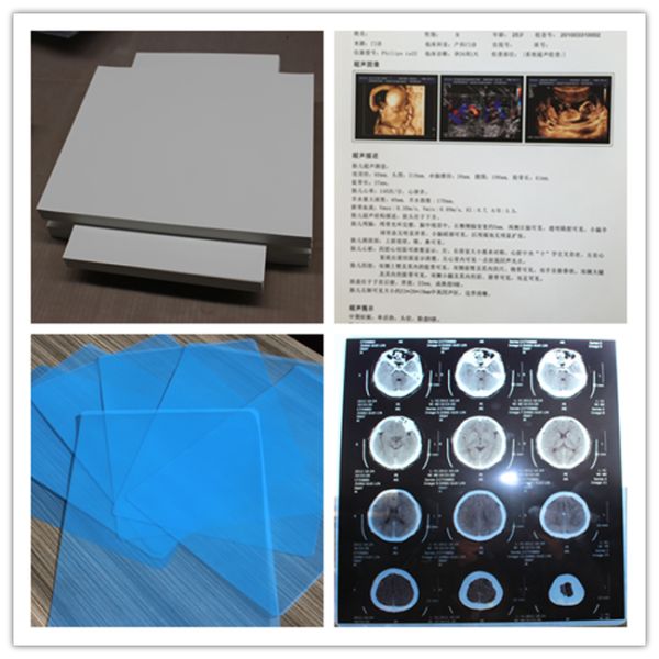 150 película de la proyección de imagen médica del laser X Ray del Mic Digitaces para las hojas del ultrasonido 100 por paquete