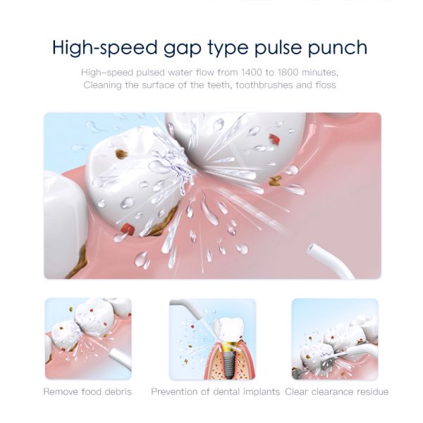 ROHS Black Dental Flossing Machine 300ml Rechargeable Oral Irrigator FC259