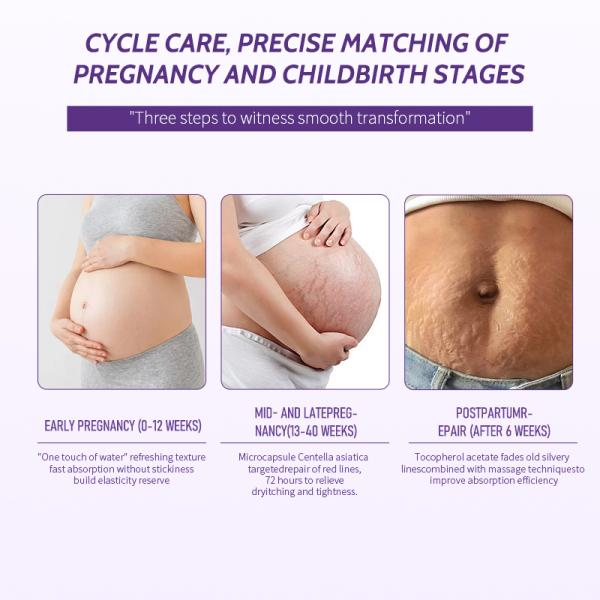 Nano Transdermal Pregnancy Skincare Line Stretch Mark Repair Treatment Cream