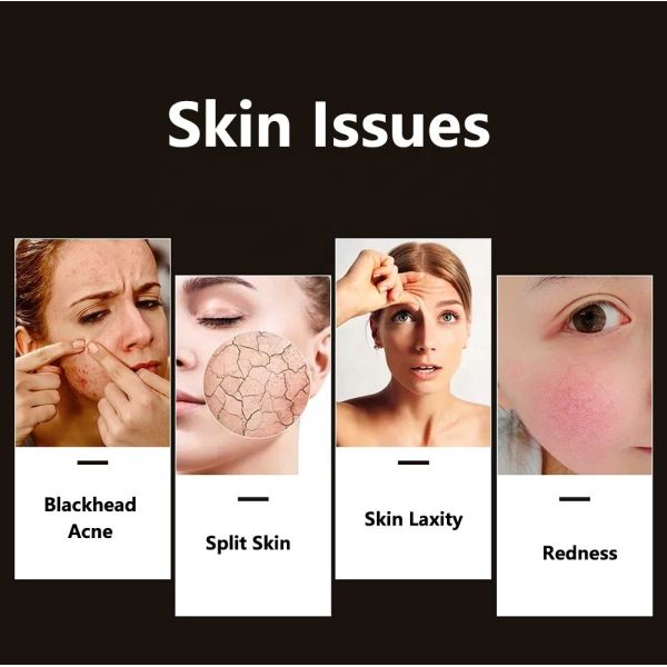 Compact Skin Led Facial Light Therapy for Acne Improvement Professional Grade