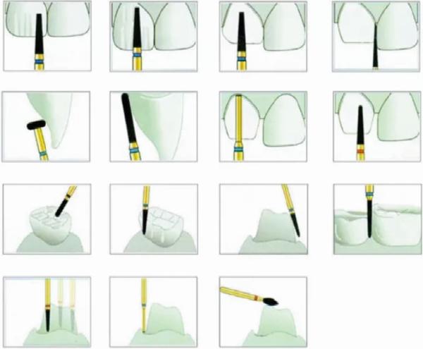 Orthodontic Burs Mani Dental Burs CRK Stainless Steel Dental Diamond Burs