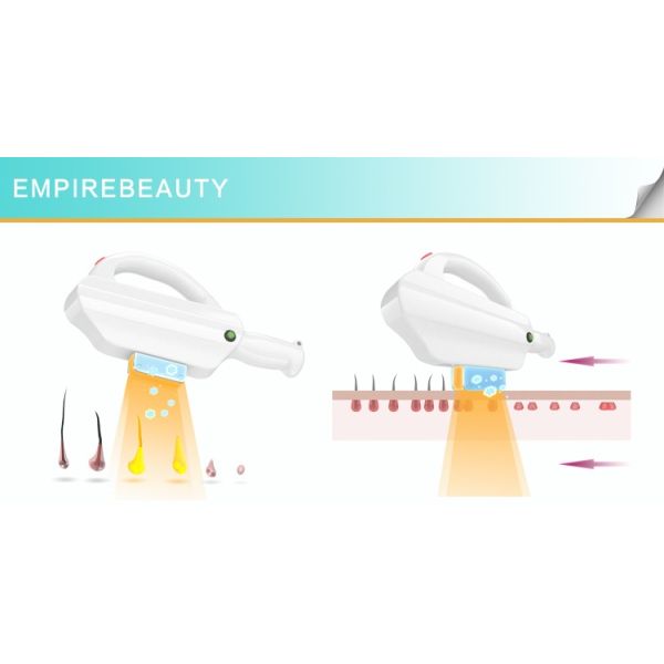 Medical Equipment CE Approved Laser IPL /SHR/ OPT hair removal machine portable ipl