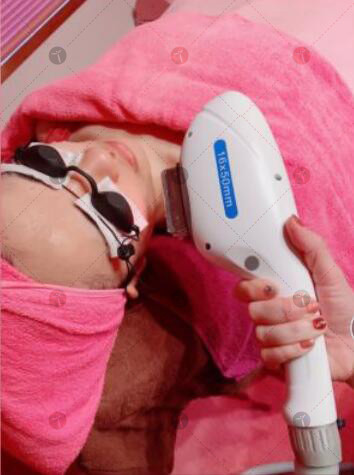 Permanent Beauty 2500W 645NM IPL Hair Removal Machine / Device