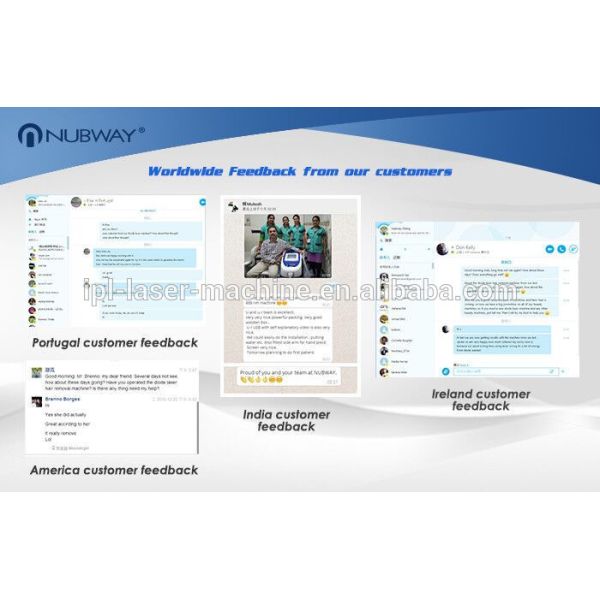 Permanent diode laser LightSheer Duet hair removal machine price for sale