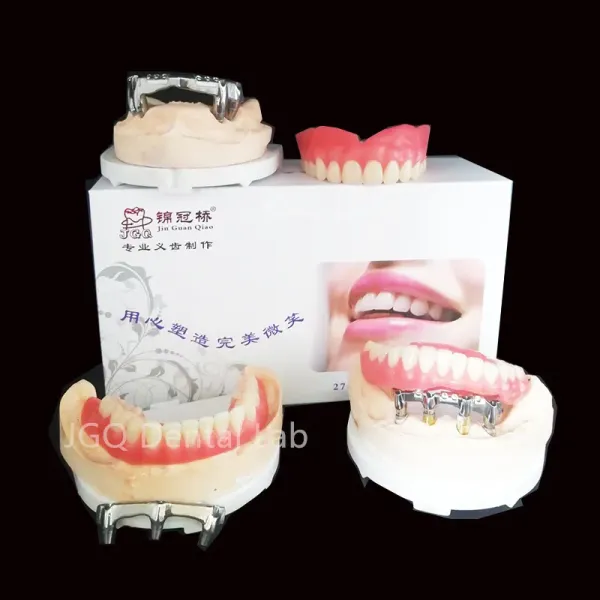 Permanent Restoration Full Contour Zirconia Crown Dental Implant with Custom Milled Titanium Frame