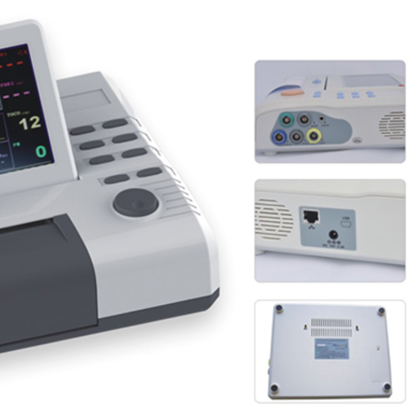 Durable Necessary Hospital Pregnant Women NST Cardiotocography Machine Ctg Machine Maternal Fetal Monitor For Baby Heartbeat
