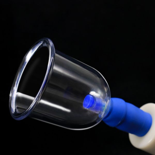 Antirheumatic Function Vacuum Suction Cups for Chinese Cupping Therapy and Massager