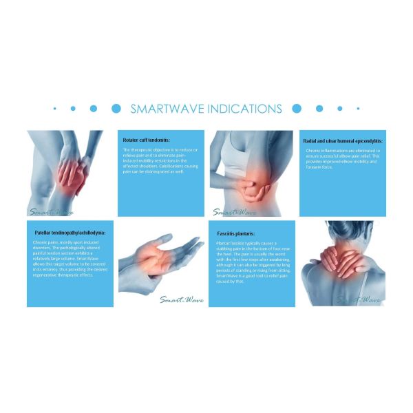 Orthopedics Rehabilitation Tennis Elbows ESWT Therapy Machine Tendonosis For Trigger Finger