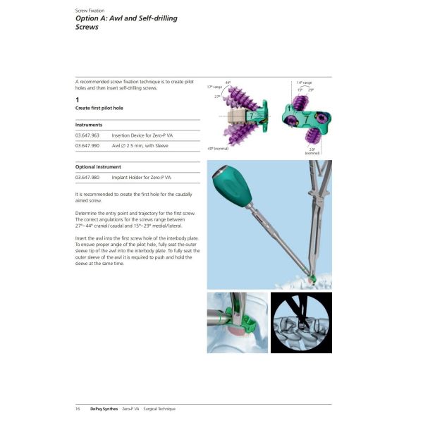 Sterilization 2 Screws Zero Profile Cage Anterior Cervical Cage Stand Alone CE Spinal Surgery